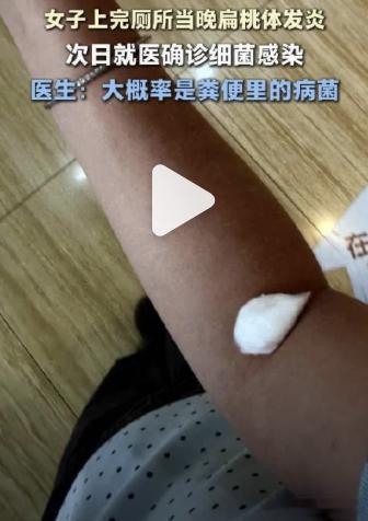 女子公司如厕感染粪便病菌无法吞咽上个厕所差点把命搭上，这届打工人太难了。上海