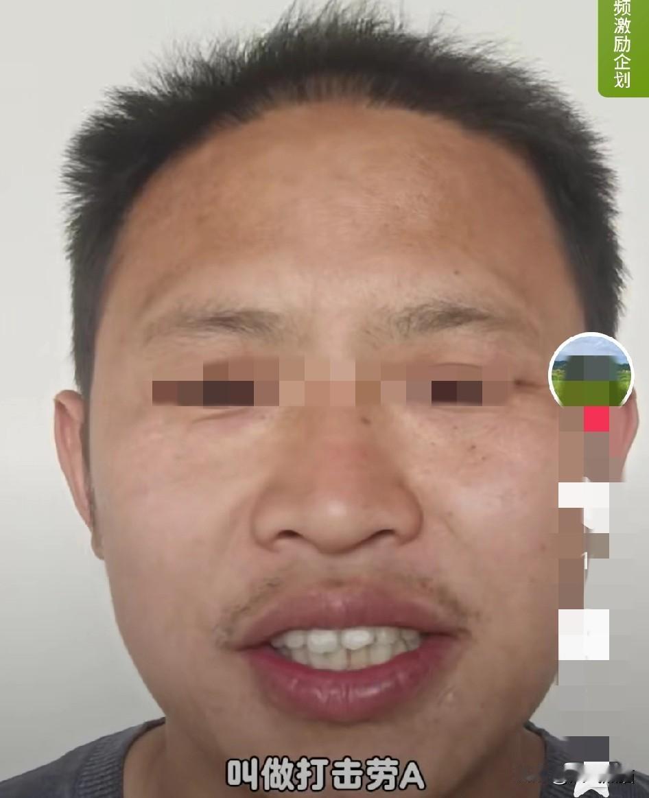 牢A是什么都捅搂了出来，他在直播中说到，“美国人鄙视华人，华人看不上中国人，但