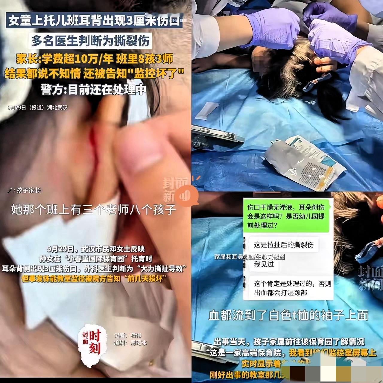 武汉这保育园可算“出名”了，干的缺德事全国都瞅见了，真让人膈应！冯女士家2