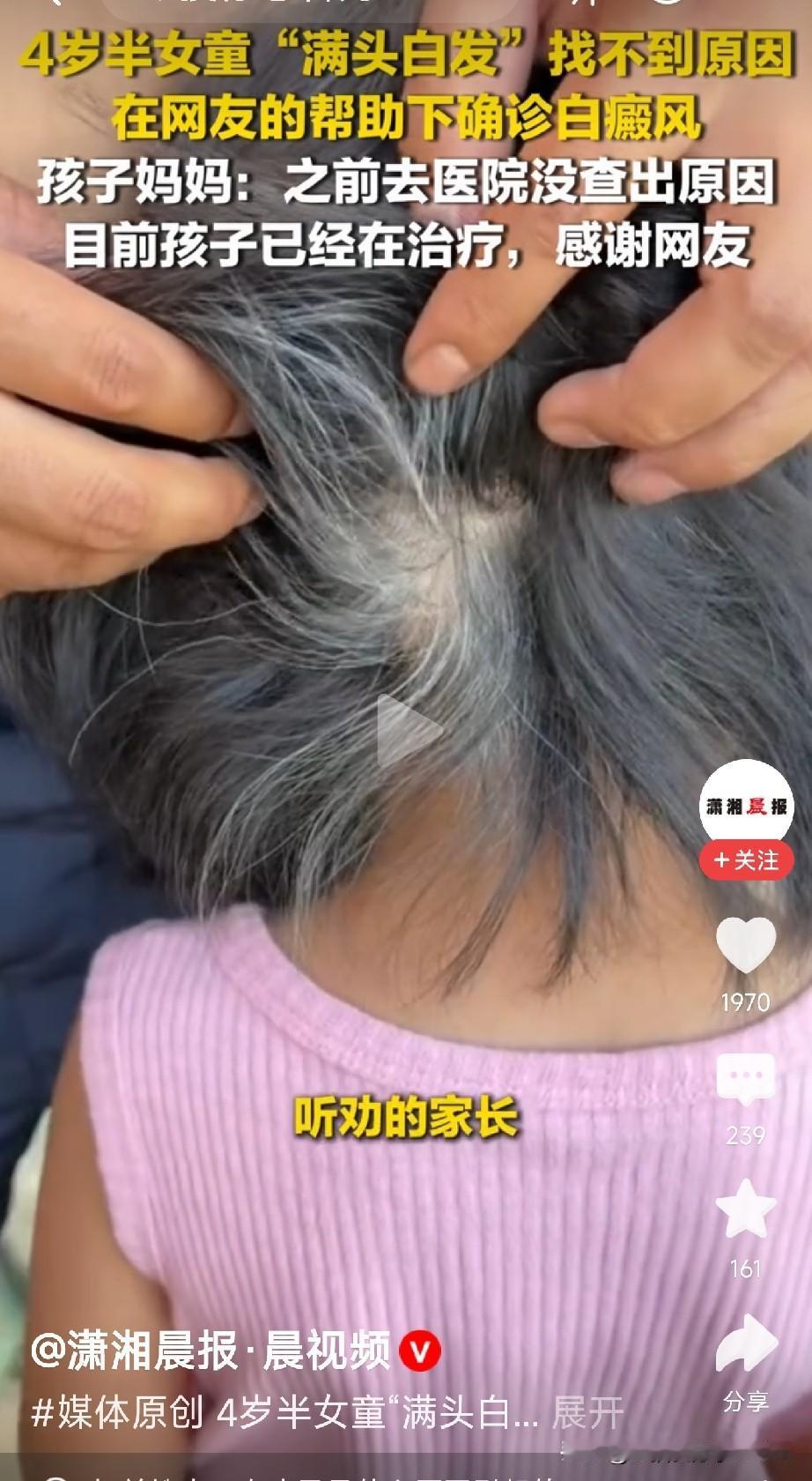 互联网的力量太强大了贵州毕节的杨女士，看着四岁半的女儿头发一点点变白，心里非