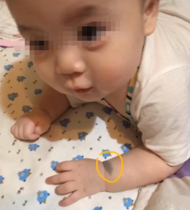 2018年，一只狗狗去世后，主人竟然意外怀孕。当孩子出生时，主人看到宝宝左手臂上