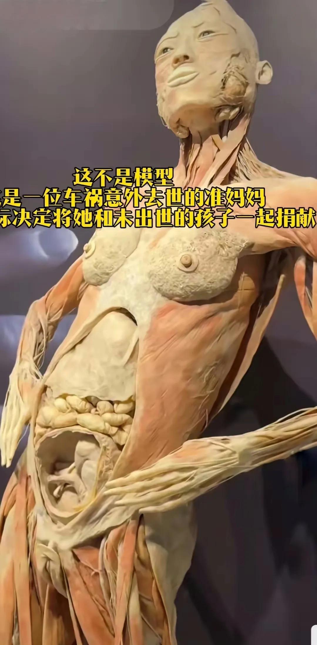 这不是人体模型，而是一个真正的女性人体标本！这个年轻的怀孕12周的准妈妈在一次交