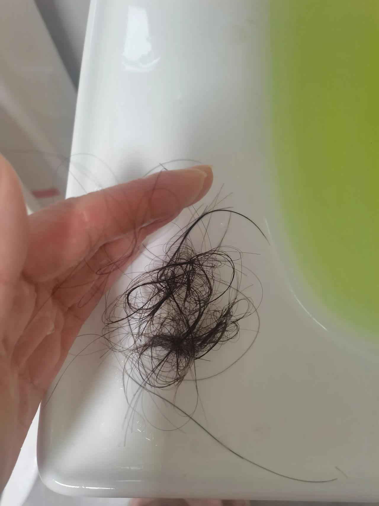 人衰老的症状之一脱发，脱发越来越严重，家里的床上，地下，感觉哪里都是头发，每天