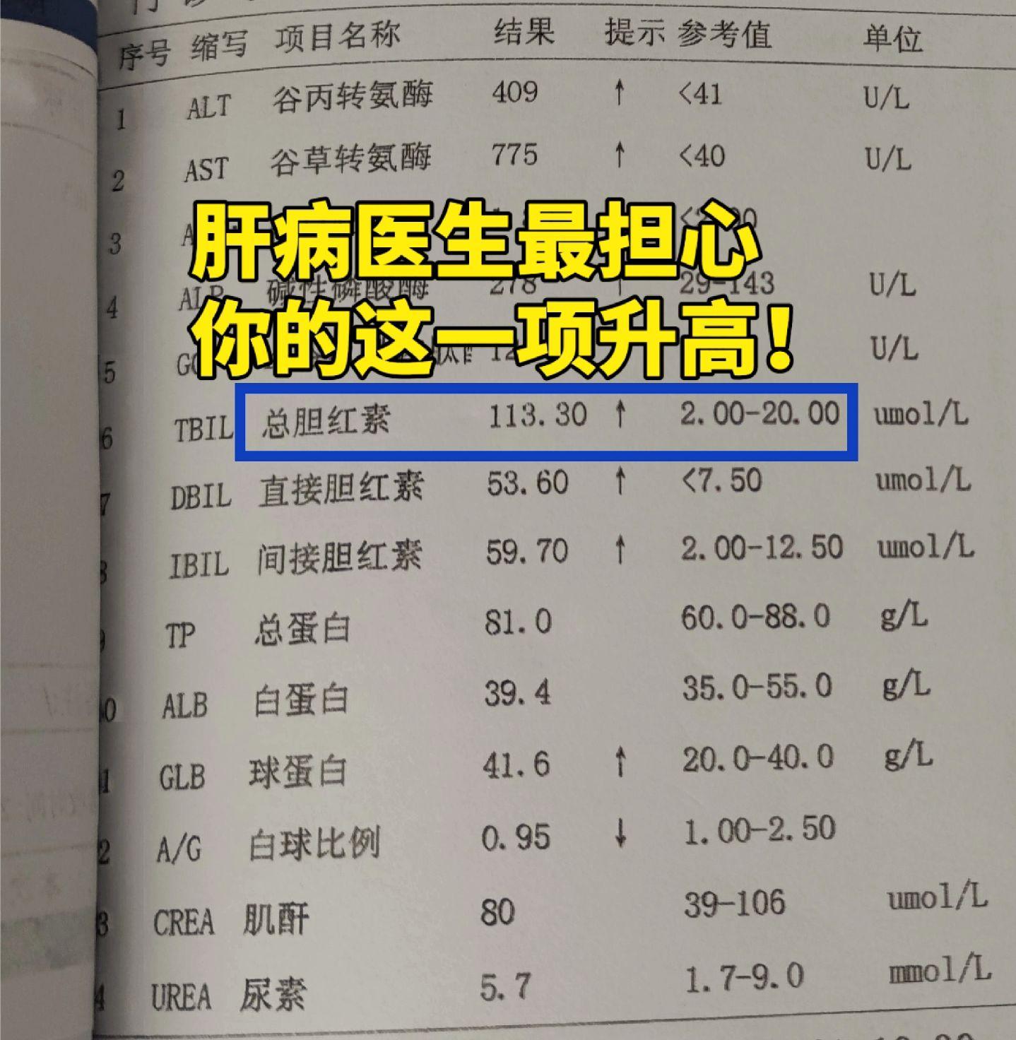 肝功能检查是肝病患者最常接触的一种检查，其中比较重要的指标有转氨酶，胆...