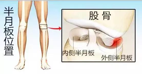 半月板损伤, 手术与保守治疗方法分析