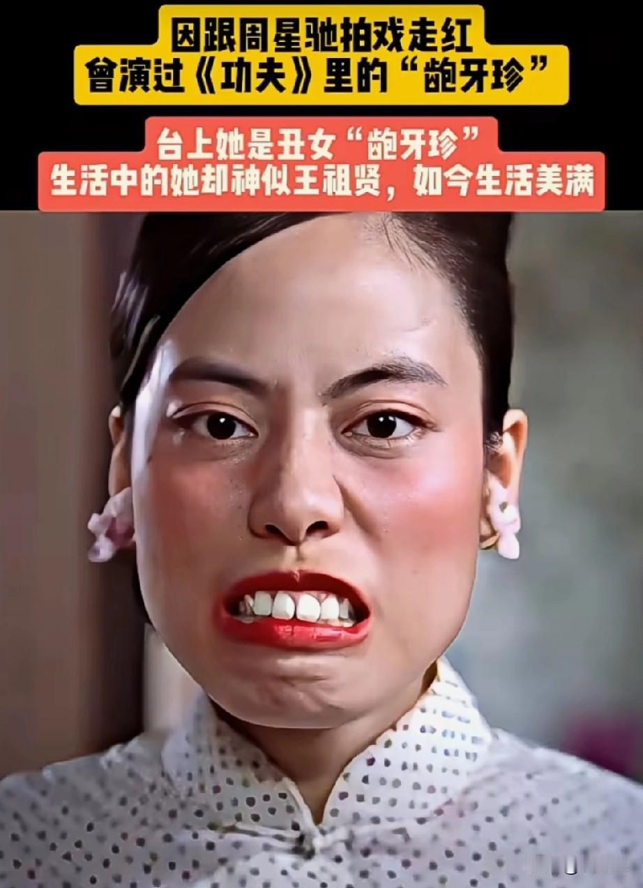 还有人记得她吗？广州人，中国内地女演员。因参加周星驰电影《功夫》饰演龅牙珍一角