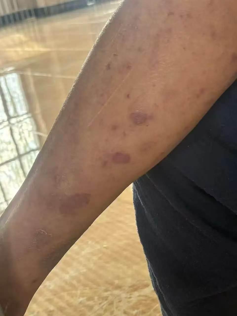 黑龙江哈尔滨，男子60多岁的岳父查出有精神疾病，被送到专科医院治疗。医院是封闭式