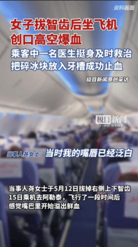 “真是冷知识！”一女子在拔牙三天后乘坐飞机，飞到高空时口腔的伤口居然撕裂了，瞬间