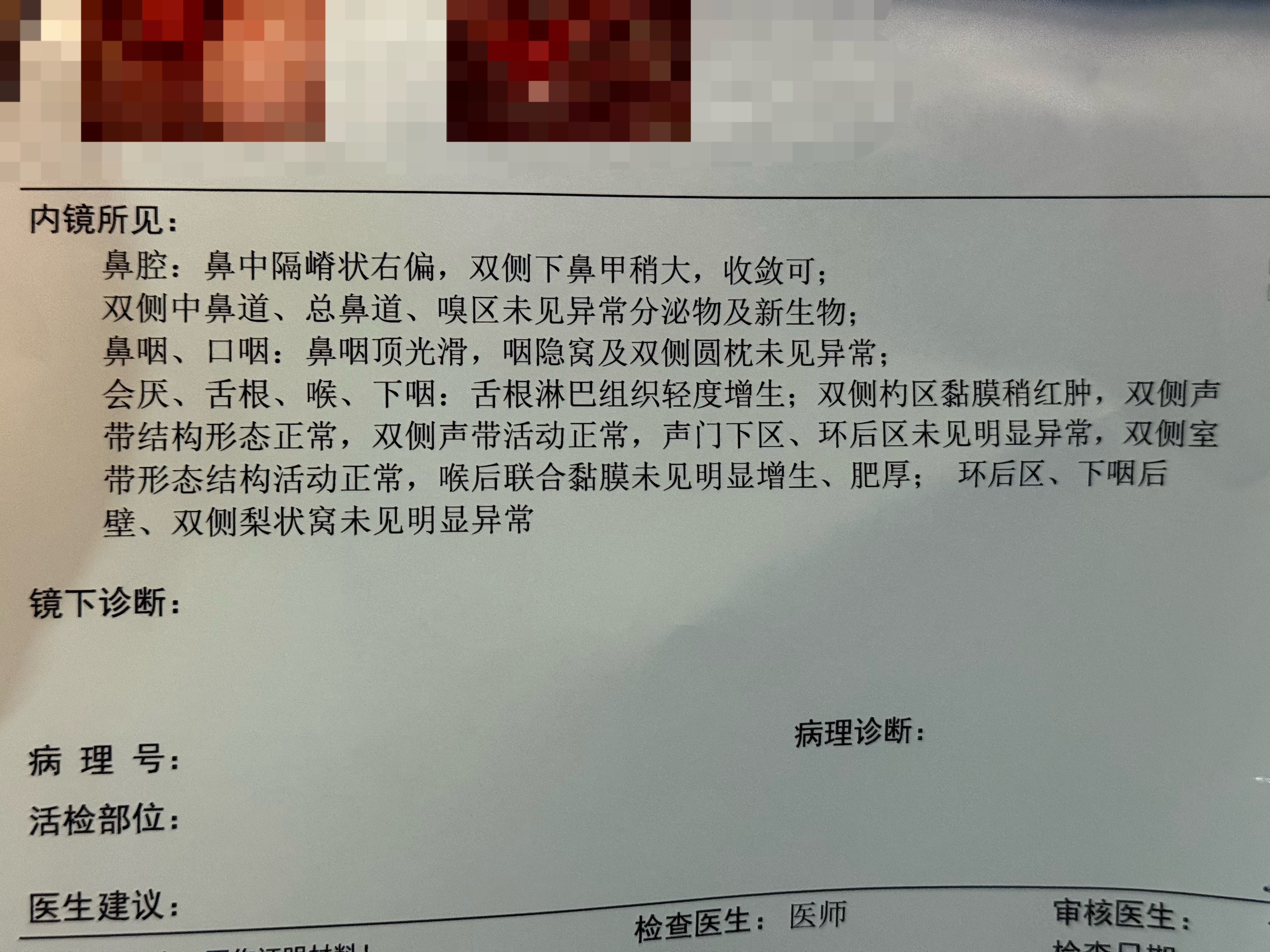 今天去做喉镜了，真的有点难受那根软线还是有点硬的，鼻子的部分还好，到喉咙