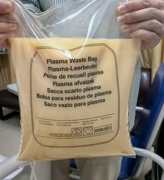 男子聚餐又去夜宵，夜宵后体内过滤出7斤油，吓坏家人。春节已经结束，相信大家在