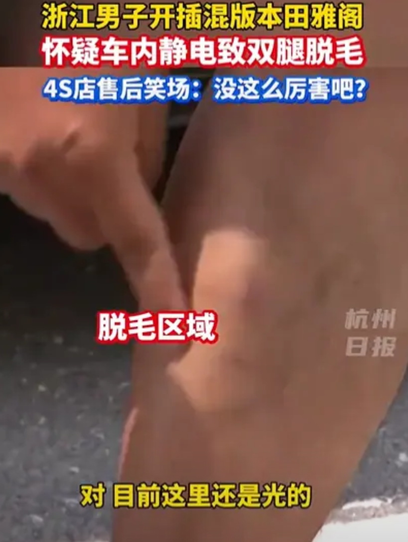 解释不清了！浙江，男子偶然发现，自己腿毛竟然快掉光了，他怀疑是汽车静电导致，大腿