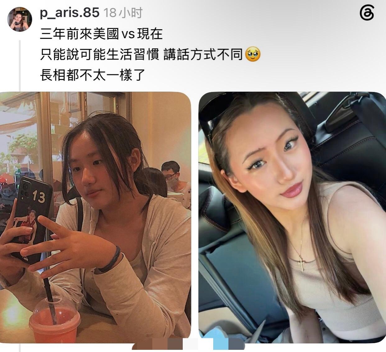 一位到美国三年的华人女子分享她这几年前后的变化：三年前来美国和现在相比，长相都不
