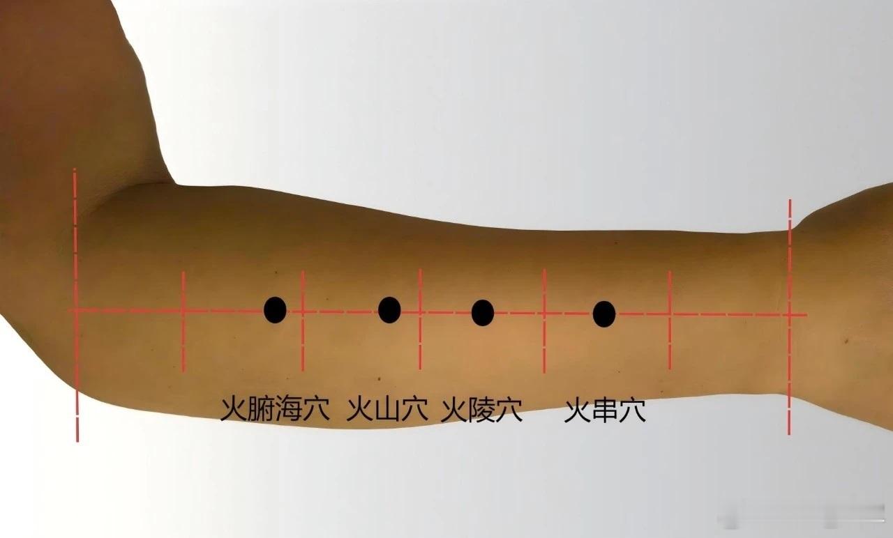 便秘要穴，火串穴火串穴源自董氏奇穴位置：在手背腕横纹后三寸，两筋骨间凹陷处。穴
