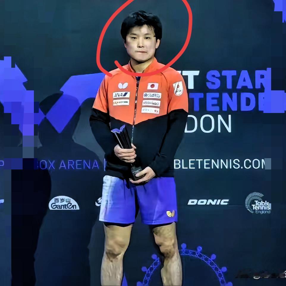 谁能想到！前一天还在赛场“狮子吼”蹦跳耍威风的张本智和，隔天就成了垂头丧气捧杯子
