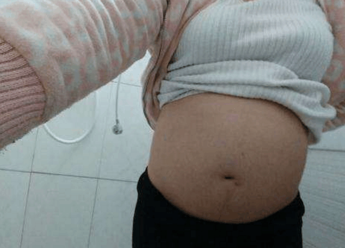 剖腹产子宫破裂, 医生要产妇多住几天, 而丈夫留下一句话就走了