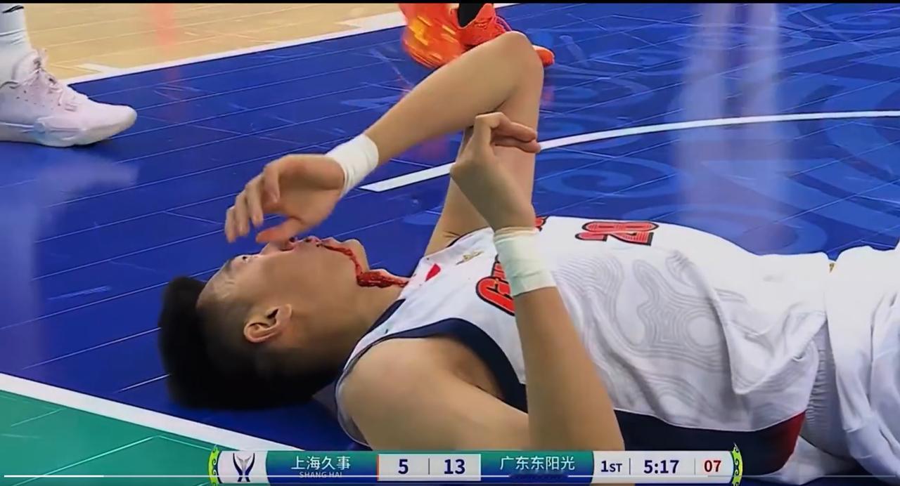 名记付政浩嘲讽上海队外援：王少杰被王哲林打到脸部导致鼻血横流，应该请古德温来点评