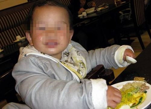 2岁宝宝不说话, 爸爸送医检查, 医生: 你们给宝宝吃了多少甜食?