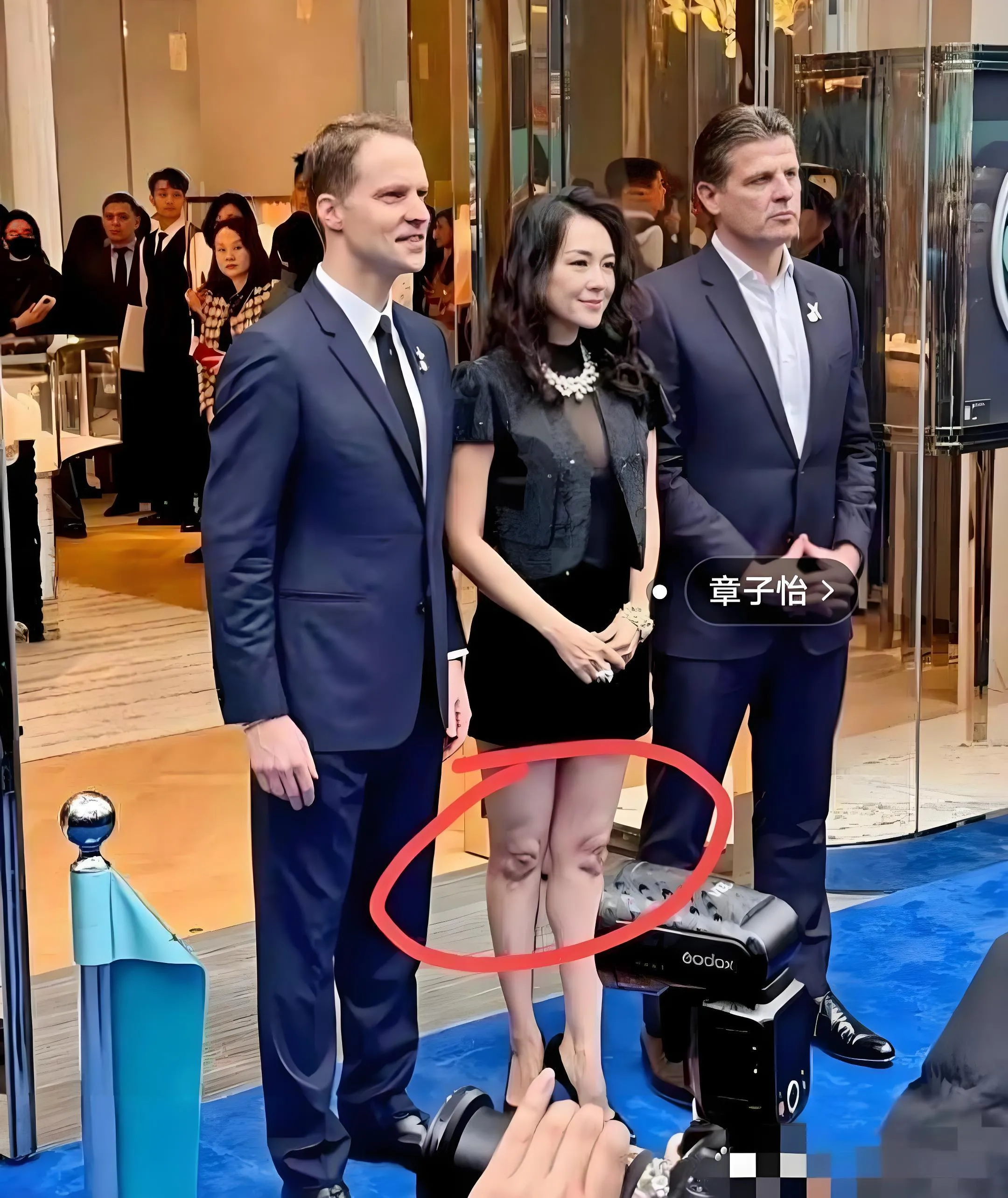 这膝盖是怎么了？[大笑][大笑][大笑]