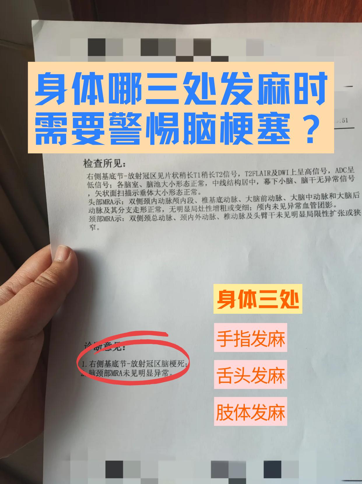 身体这三个地方突然发麻，可能是脑梗在“报警”！最近，张阿姨在厨房做饭时，突然