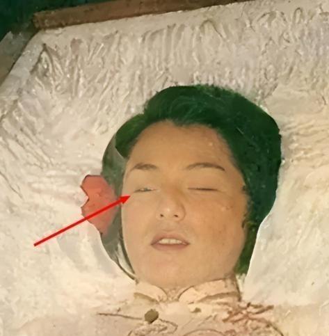 1985年，翁美玲服下安眠药后，又打开了煤气自杀，她去世时，脸上没有任何