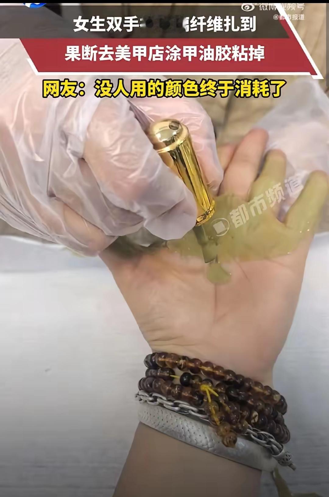 浙江，一女生双手被玻璃纤维扎到，可她既没有自己拔，没有去医院，而是走进了一家美甲