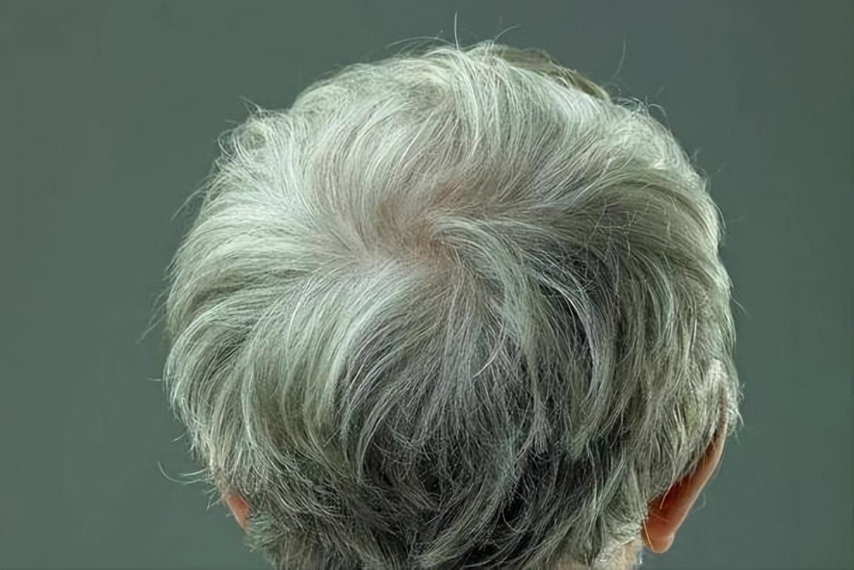 寿命长不长，头发先知？60岁后，白发少的人活得更久？告诉你答案很多人都听说过