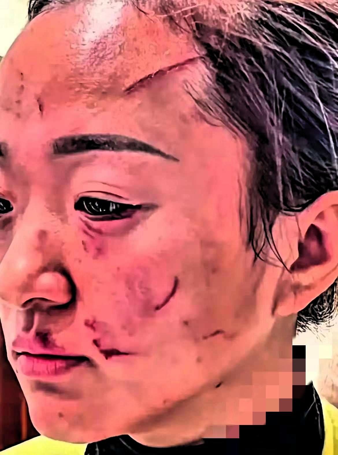 婆媳动手赔5万断来往，这哪是家务事，分明是相处越界的“天价罚单”！没有血缘