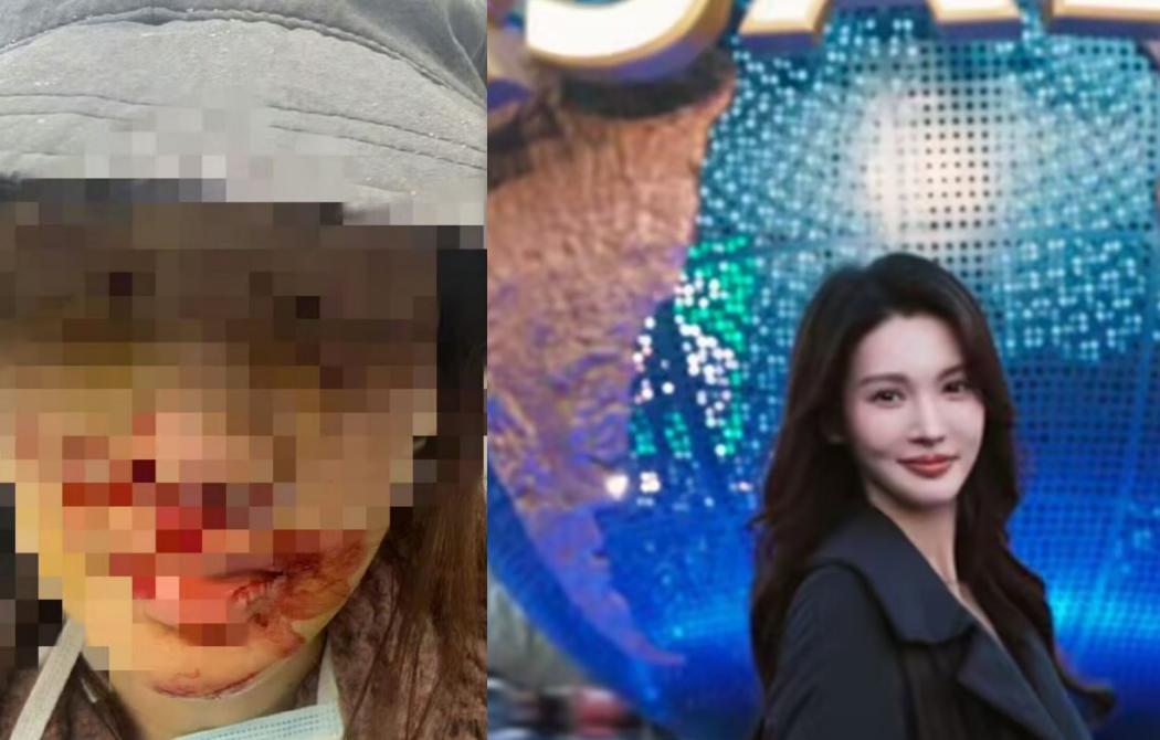 谁有金晨电话啊？能不能帮我问问她在上海哪家医院治的伤，哪个医生那么厉害可以手术完