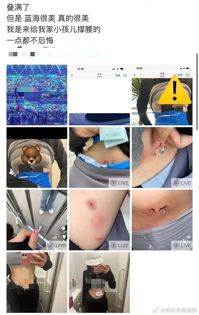 仍记得大腿藏灯牌被电池烫伤的楼丝，肉都皮开肉绽的程度……楼丝疯狂程度只有更癫没有
