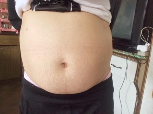 24周孕妇床上有血迹, 公公紧急送医, 听到医生的话, 孕妇红了脸