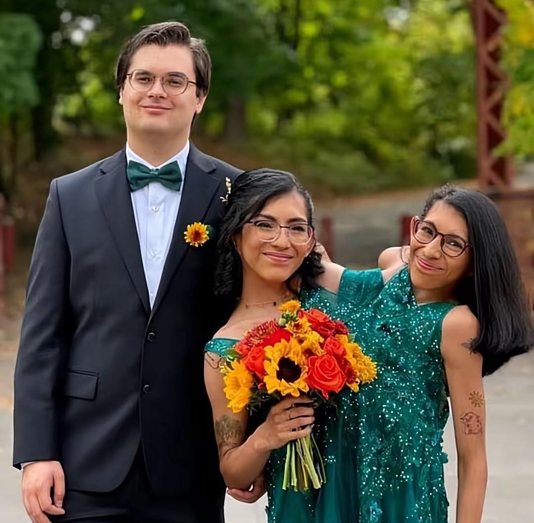 美国一对共用生殖系统的连体姐妹中的妹妹结婚了！小姐妹俩的脊柱下半部分相连，每人