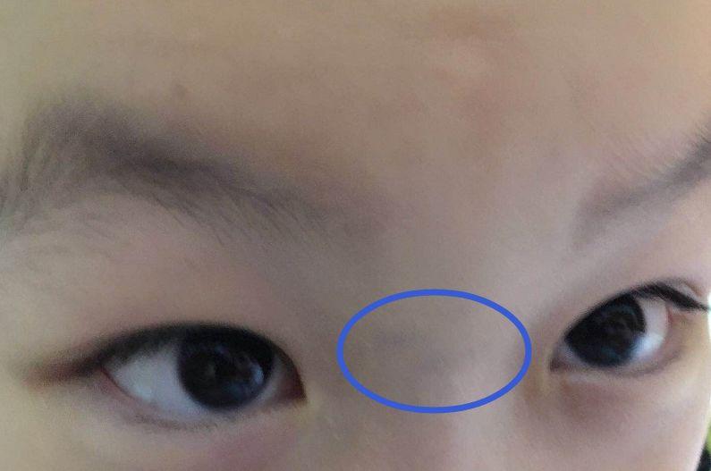 小宝宝脸色发黄和感冒有关吗 2个月婴儿脸色发黄