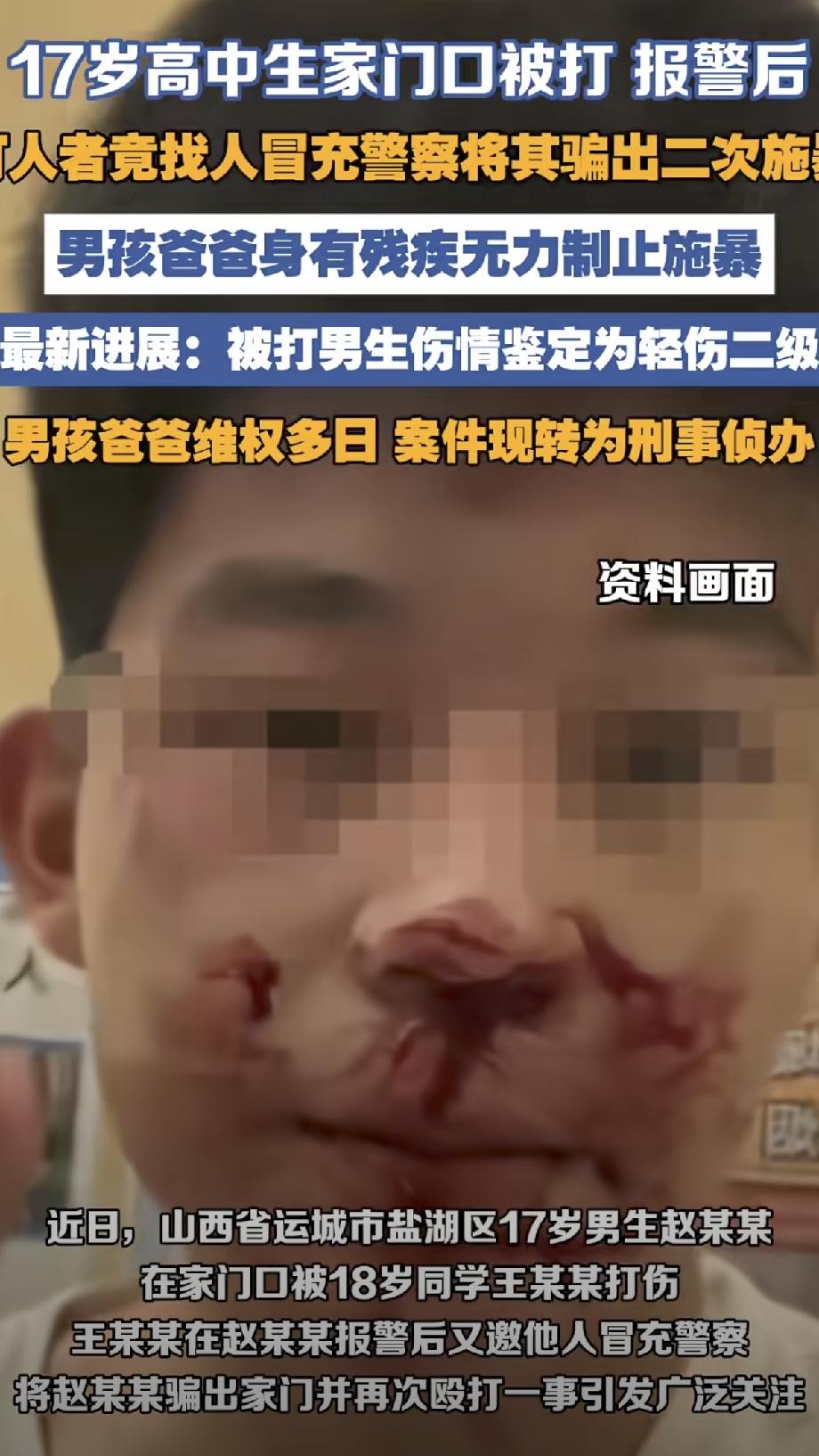 山西运城两次被打的男孩伤情鉴定出来了，轻伤二级，这下打人者慌了，他这辈子算是玩完