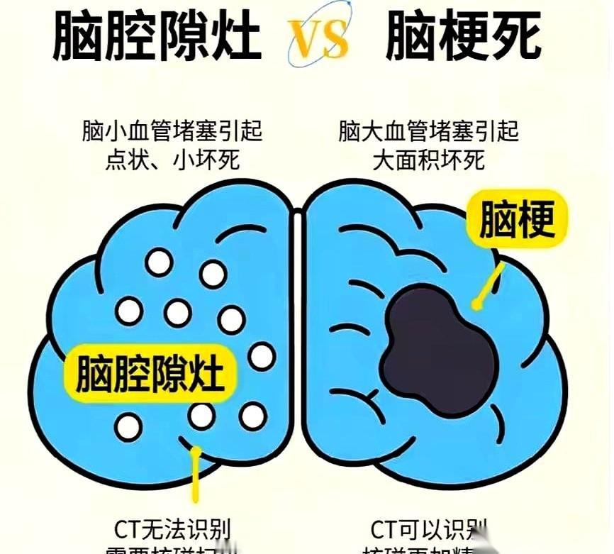 我邻居老张，早上伸手去拿桌上的水杯，就这么一个动作，他手悬在半空，停住了。杯子