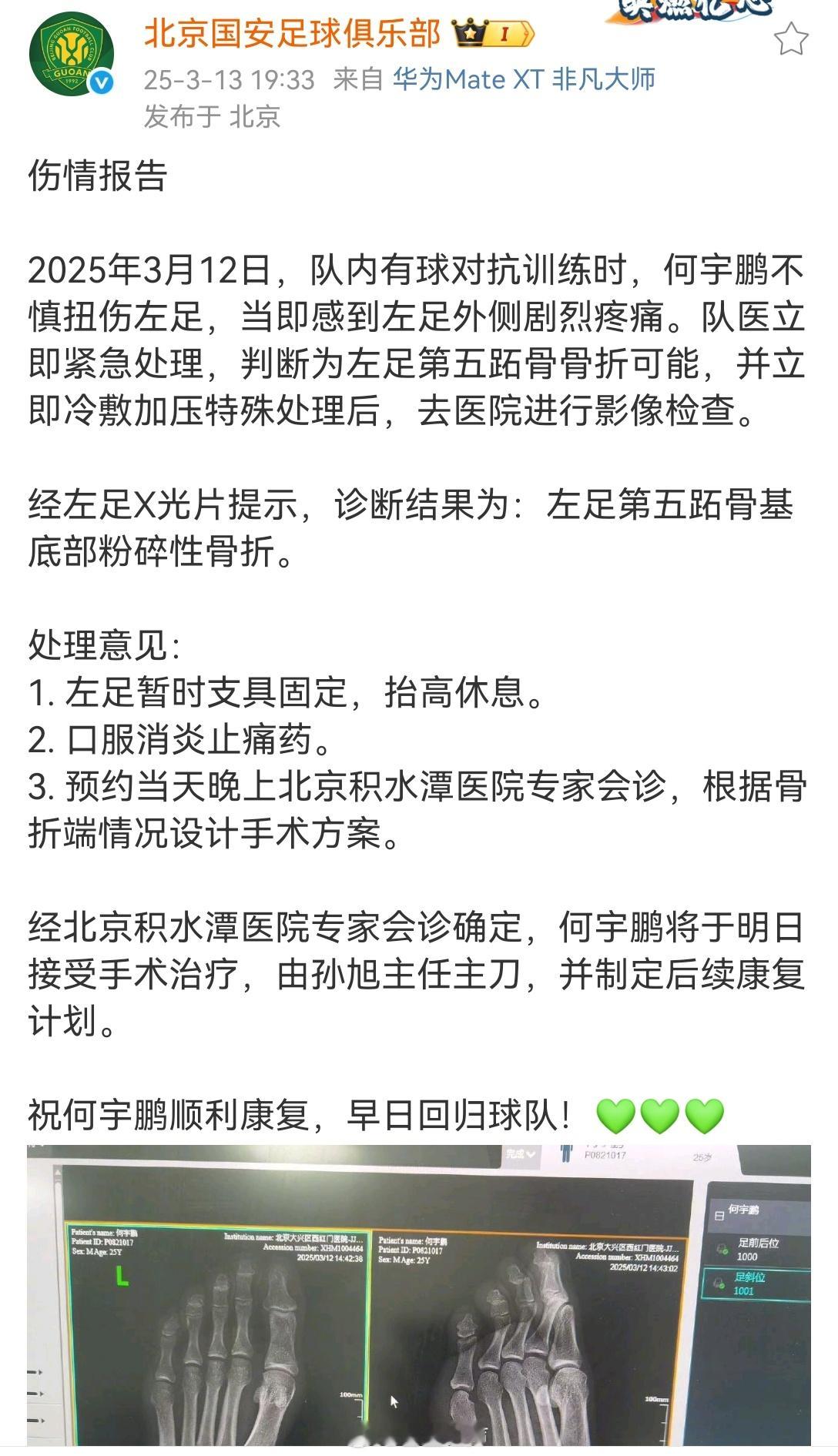 北京国安足球俱乐部官宣3位球员受伤，何宇鹏、王刚、张源。​​​