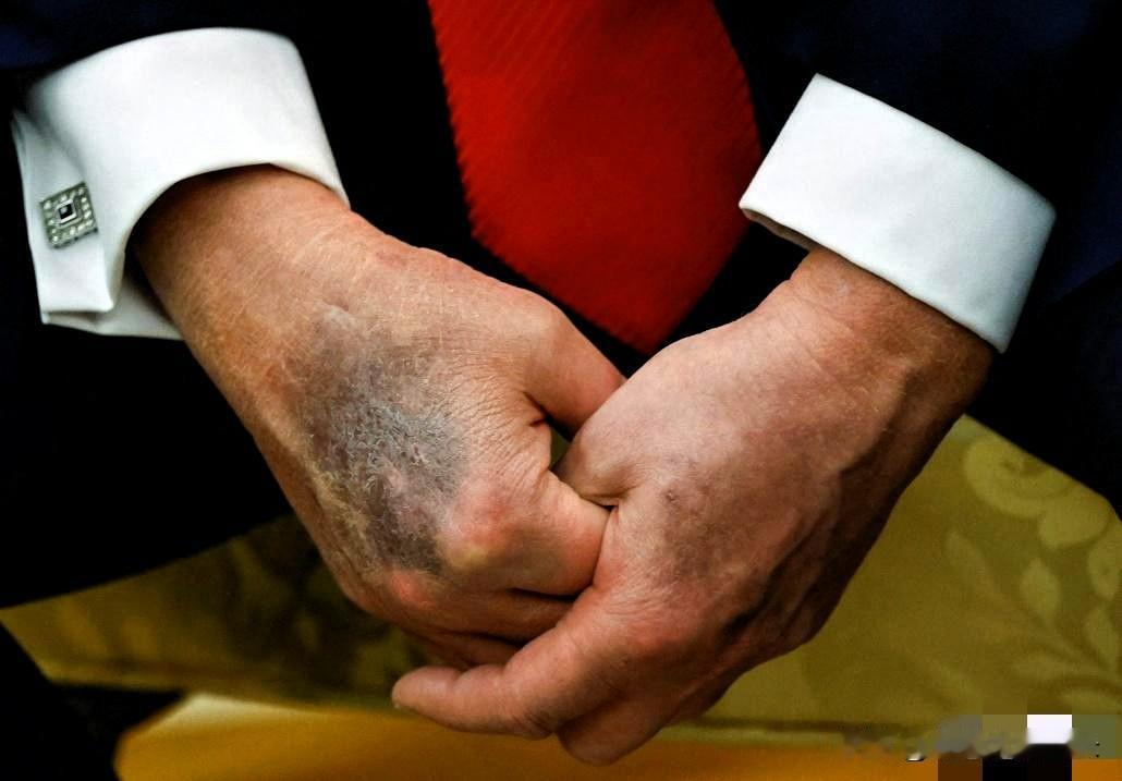 终于，特朗普承认了！特朗普这次算是对《华尔街日报》交了实底。之前大家还猜他