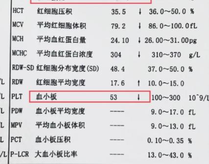血常规中有一个危险指标，其数值低于这个数，可能你已经肝硬化了！ 每次拿到血常