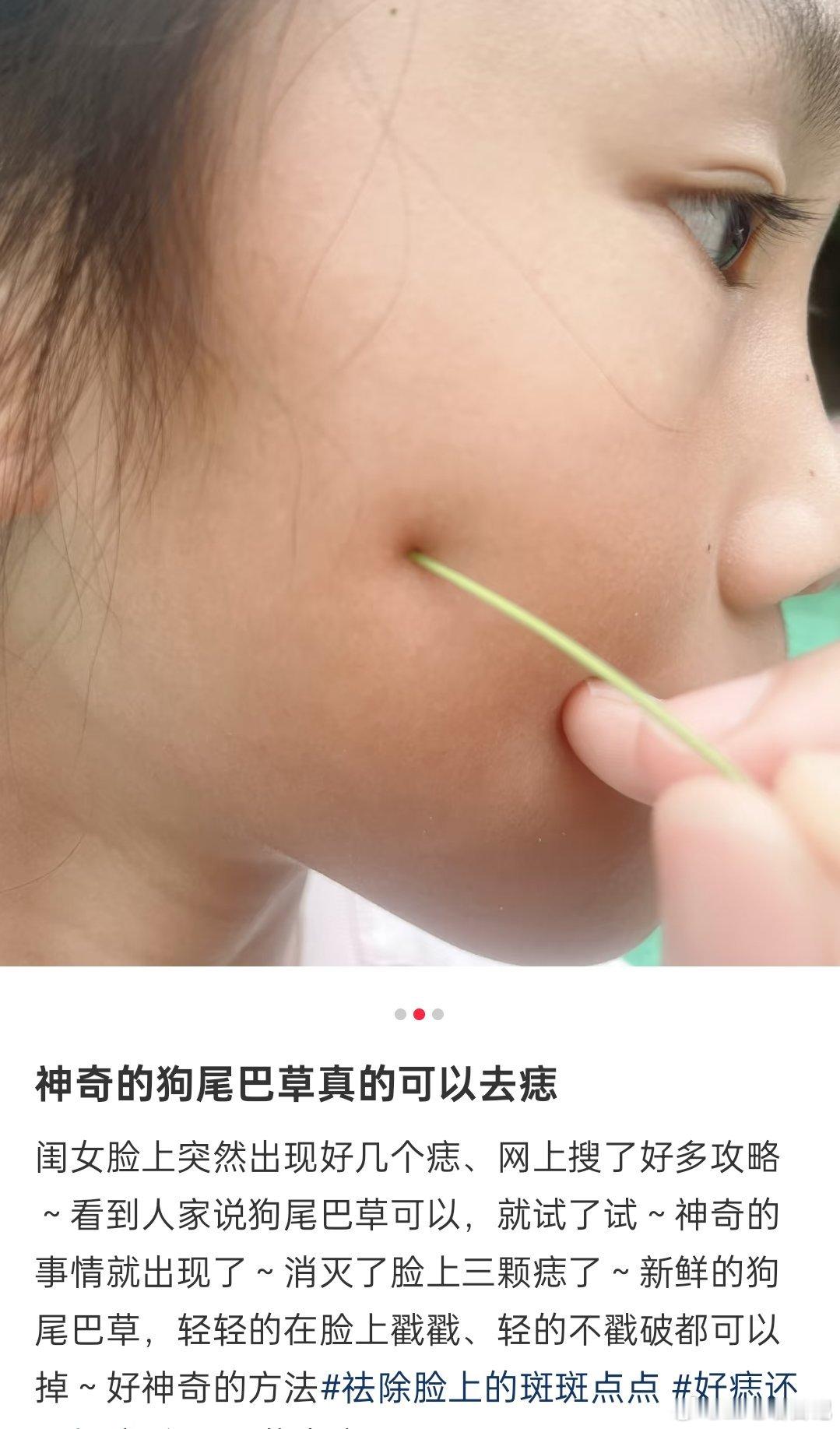 一个网友分享了用狗尾巴草去痣的帖子，感觉好小众的说法，这原理是什么啊？如果狗尾巴