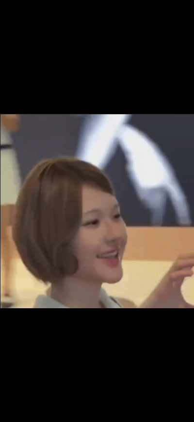 这下巴是打了玻尿酸？​​​