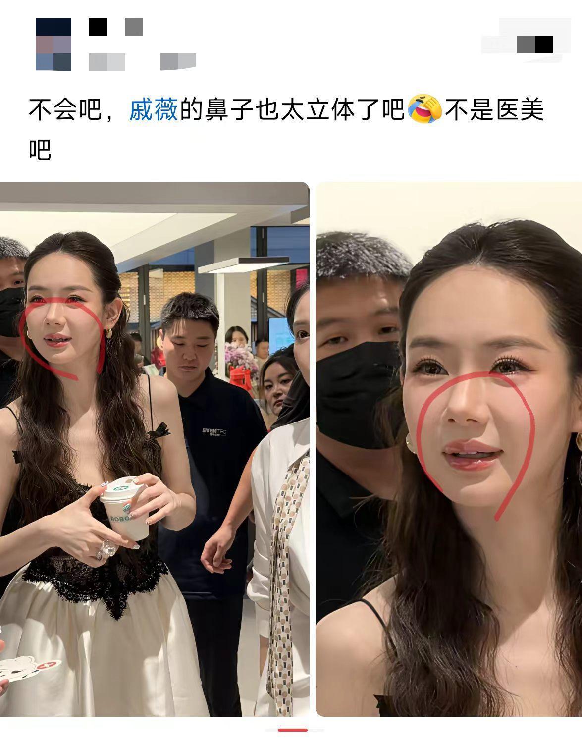 医美现在太普遍了，也没啥大惊小怪。
