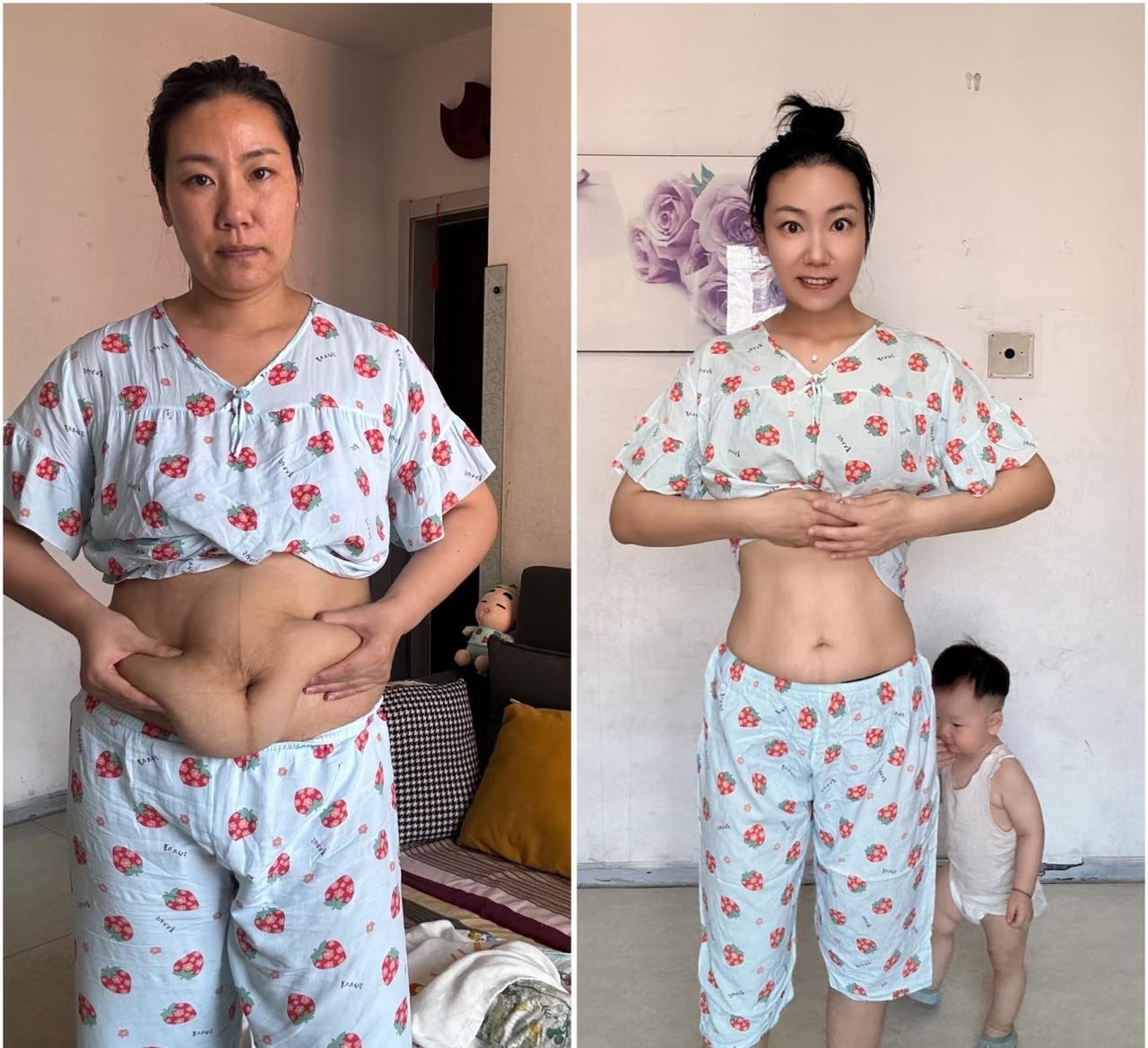 本人减肥1年半了，硬生生从160斤减到了120斤，没吃任何减肥产品，也没模仿任何