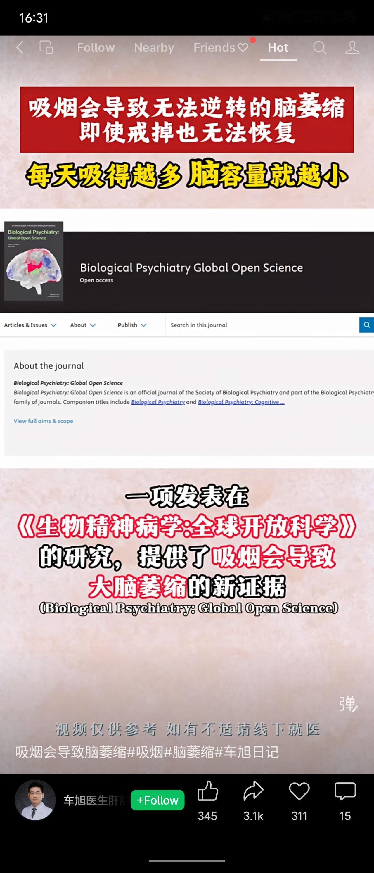 最新研究基于3.2万余名欧洲参与者的脑成像数据，证实吸烟量与脑容量呈剂量依赖性负