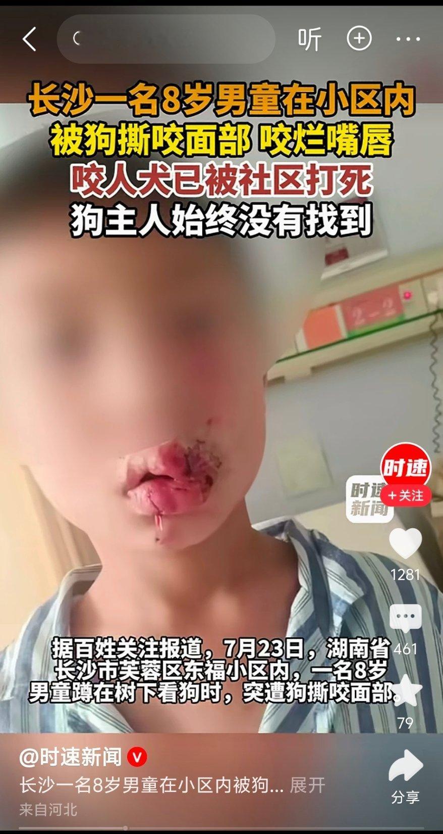 狗主人消失了？爱狗明星们呢？要不要为人类发声？