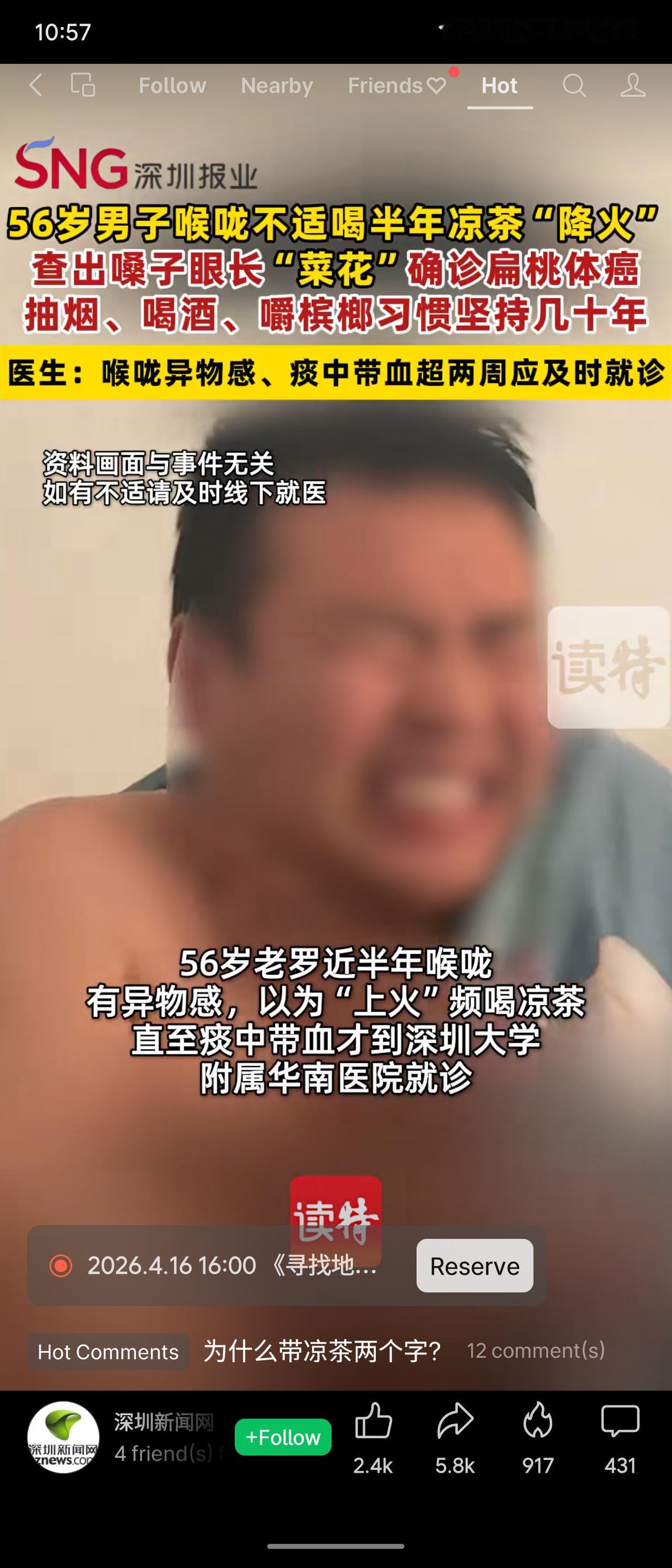 56岁男子老罗喉咙不适半年，以为是上火，连喝半年凉茶，结果确诊扁桃体癌（形似菜花