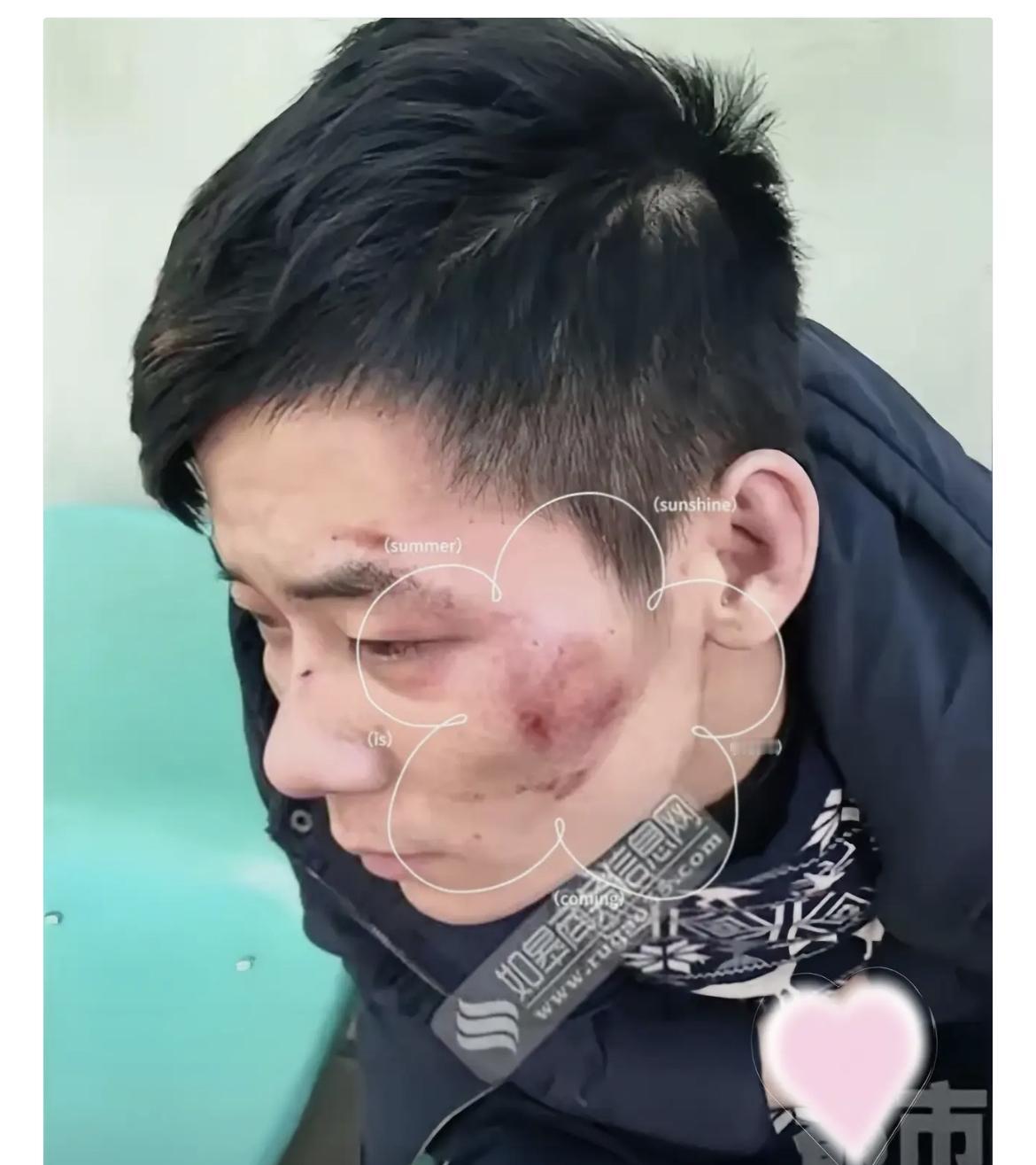 大半夜被一群人死命追着打，这大哥干了件最聪明的事——直奔武警大门5月10号凌