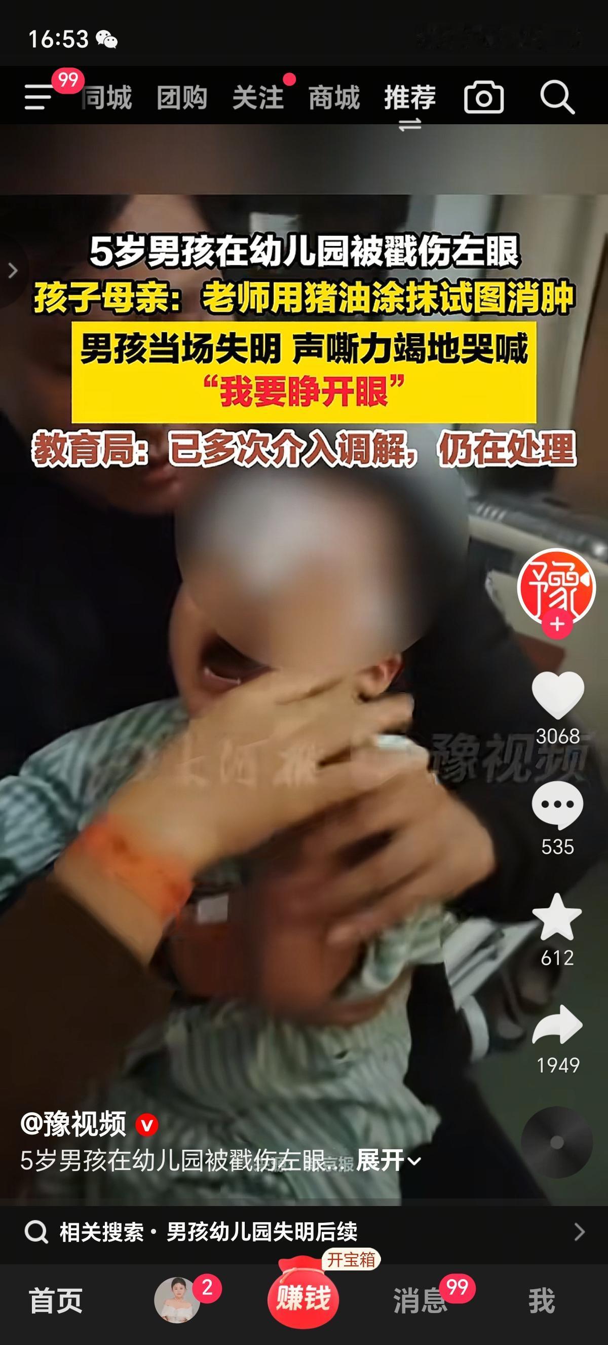 5岁孩子上幼儿园眼睛被铅笔戳伤了，幼儿园老师发现孩子眼睛受伤没急着送医院，先用猪