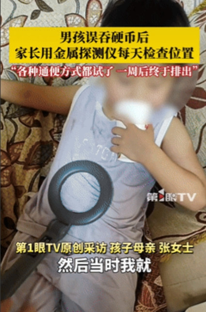 “是个聪明人！”河南，一小男孩不小心吞下了一枚1元硬币，家长发现后，紧急带孩子去