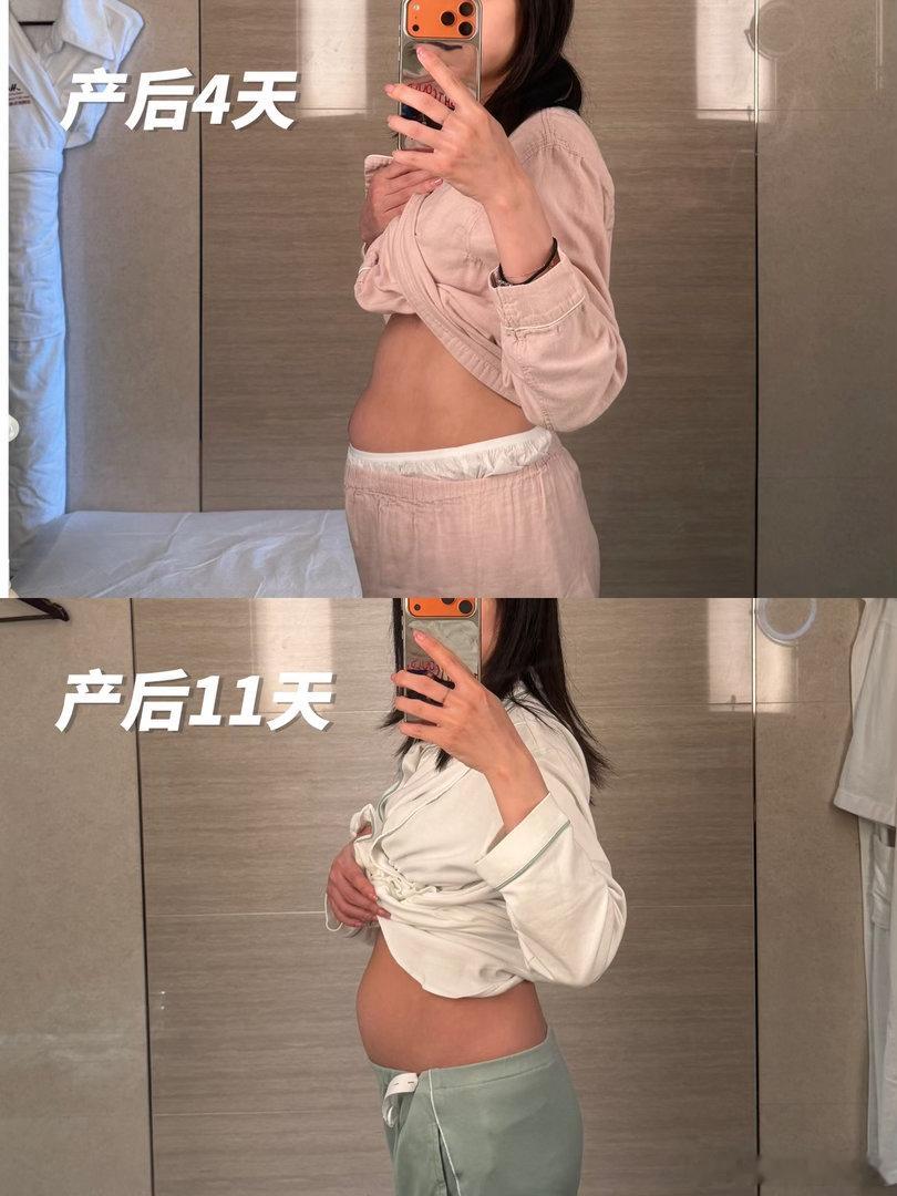 感觉好像有点变化，但是体重这几天没有掉了，还有十五六斤可咋整[哭哭]腰粗肚子大松松垮垮孕激素确实会让