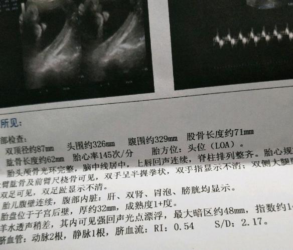 预产期1.10号, 提前10天37周卸货7斤儿子, 跟大家分享下好孕症状