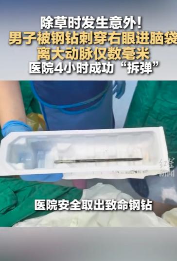 5月23日，广东佛山发生了一场让人看完头皮发麻的意外。一名中年男子在户外做除草作